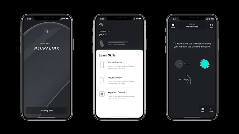 Elon Musk, Neuralink ile Zihninizi Kullanarak Bilgisayarları Kontrol Etmek İstiyor! - görsel 3